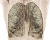 Tomografía computarizada coloreada de pulmones sanos . - foto de stock
