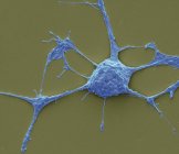 Scanning electron micrograph (SEM) of a PC12 neurone in culture. — Stock Photo