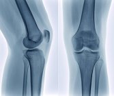 Healthy knee joint anatomy — Stock Photo