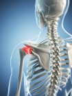 Focus of inflammation localized in shoulder joint — Stock Photo