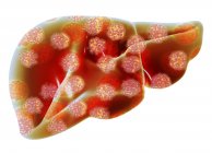 Liver overlaid with hepatitis B viruses — Stock Photo