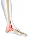 Pain affecting Ankle, — Stock Photo