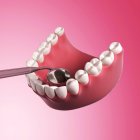Zahnspiegel und menschliche Zähne — Stockfoto