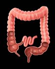 Coupe transversale d'un gros intestin — Photo de stock