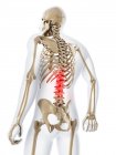 Lower back pain — Stock Photo