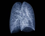 Tomografía computarizada (TC) 3D coloreada de los pulmones sanos de un paciente de 30 años . - foto de stock
