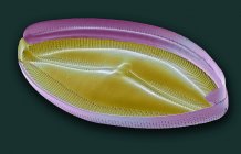 Freshwater single diatom — Stock Photo