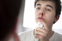 Junger Mann mit Nasenbluten blickt in Spiegel. — Stockfoto