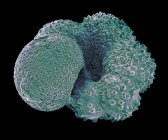 Farbige Rasterelektronenmikroskopie (sem) der Schale (Test) einer Globigerina sp. Planktonisches Foraminiferan. — Stockfoto
