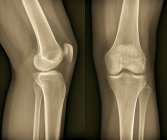 Здоровая анатомия коленного сустава — стоковое фото