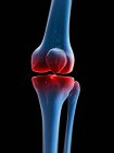 Візуальне відображення болючого коліна — стокове фото