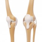 Tampas de joelho e ligametos — Fotografia de Stock