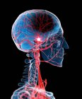 Anatomia patológica do acidente vascular cerebral — Fotografia de Stock