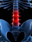 Painful lumbar spine — Stock Photo