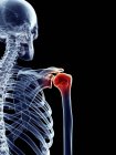 Human shoulder pain — Stock Photo