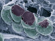 Tecido adiposo, micrografia eletrônica de varredura colorida (MEV). As células de gordura (adipócitos, redondos) são cercadas por fibras colágenas . — Fotografia de Stock