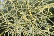 Грам-позитивні бактерії Nocardia — стокове фото
