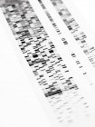 Primo piano dell'autoradiogramma del DNA su sfondo bianco . — Foto stock