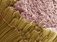 Tendão mostrando feixes de fibras colágenas — Fotografia de Stock
