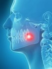 Tooth pain visualization — Stock Photo