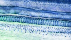 Micrografía ligera (LM) de una sección a través de un tejido de girasol (helianthus annuus) que muestra traqueoides espirales, un tipo de xilema
. - foto de stock