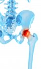 Human hip pain — Stock Photo