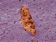 Micrografía electrónica de barrido de color (SEM) de una sección a través de una vena en el hígado, que está llena de glóbulos rojos (eritrocitos, rojos) ). - foto de stock
