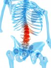 Dor vertebral humana — Fotografia de Stock