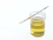 Urine sample with test strip on white background. — Stock Photo