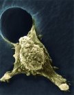 Micrographie électronique à balayage coloré (MEB) d'une cellule tumorale, montrant des protubérances pseudopodiques (en bas à gauche et à droite), une caractéristique importante des cellules activement mobiles . — Photo de stock