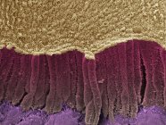 Micrografia eletrônica de varredura colorida (MEV) de um ducto biliar fraturado . — Fotografia de Stock