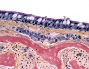 Epitelio sinusal paranasal - foto de stock
