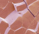Micrógrafo electrónico de barrido de color (SEM) de una sección a través del músculo esquelético fracturado para mostrar grandes haces musculares, o fascículos (verde), rodeados de tejido conectivo perimysium (rosa ). - foto de stock