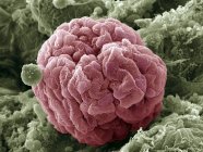 Glomérulo renal y células podocitarias - foto de stock