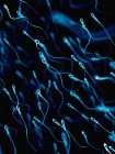 Human sperm cells — Stock Photo