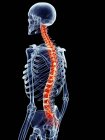 Dolore alla colonna vertebrale umana — Foto stock