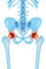Douleur de hanche humaine — Photo de stock