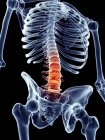 Dor vertebral humana — Fotografia de Stock