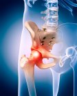 Pain in hip joint — Stock Photo