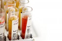 Labelled test tubes with blood samples. — Stock Photo