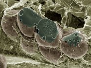 Tejido graso (adiposo), micrografía electrónica de barrido de color (SEM). Las células grasas (adipocitos, redondos) están rodeadas de fibras de colágeno. . - foto de stock