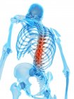 Localizzazione del dolore alla colonna vertebrale — Foto stock