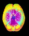 Произведения искусства Масканьи человеческого мозга — стоковое фото