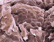 Farbige Rasterelektronenmikroskopie (sem) von Plattenepithelzellen auf der Hautoberfläche. — Stockfoto