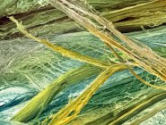 Micrographie des fibres tendineuses — Photo de stock