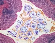Magen mit parasitären Nematodenwürmern infiziert — Stockfoto