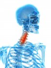Pain localized in cervical vertebrae — Stock Photo