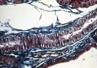 Micrografía ligera de una sección longitudinal a través de una arteriola sana . - foto de stock