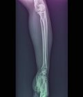Cotovelo normal e articulações do pulso, raio-X — Fotografia de Stock