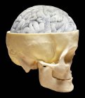 Human Brain and skull — Stock Photo